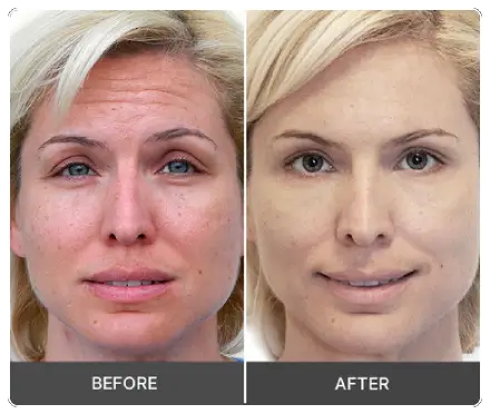 Idrotherapy Cream